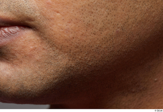 HD Face Skin Henri Sanaky cheek chin face skin pores…